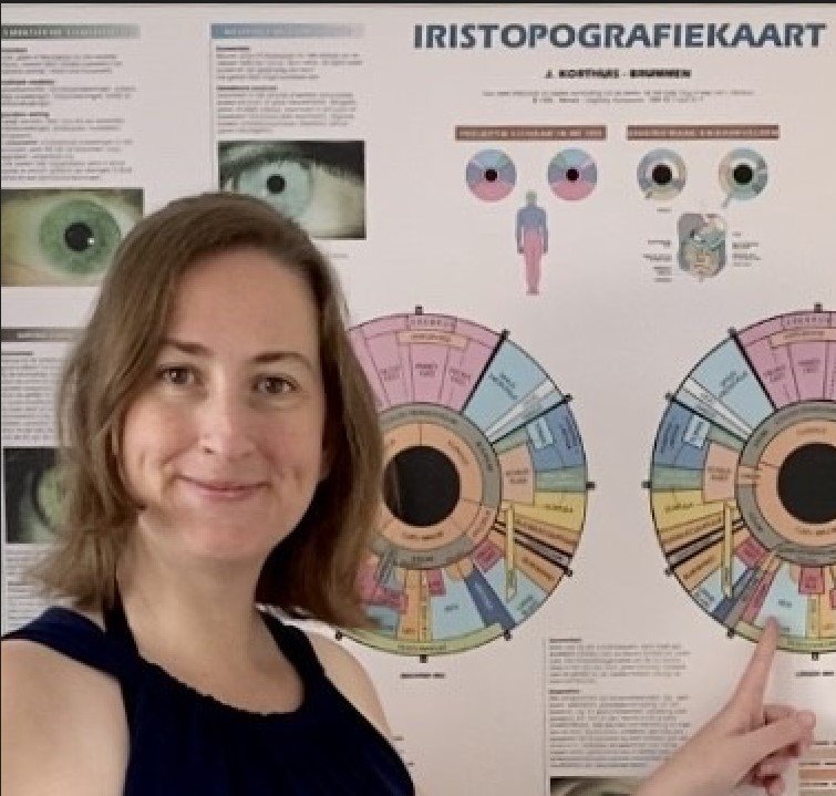 iriscopie